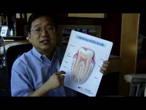 Diş Beyazlatma İpuçları Ve Teknikleri: Nasıl Beyazlatma Şeritler İş Kret