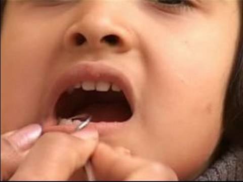Bebek Diş Çıkarma Belirtileri Ve Yardım: Bebek Diş Çıkarma Programı