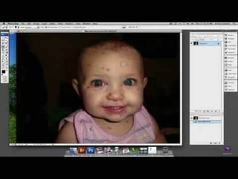 Photoshop Araç İpuçları: Photoshop Araç Şifa Spot