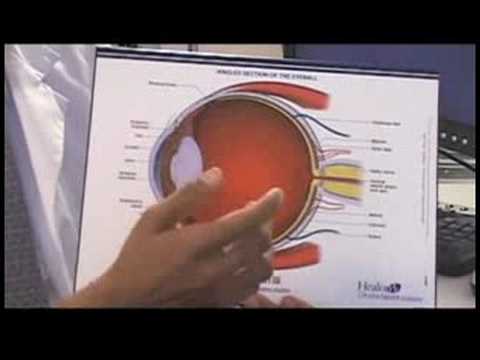 Glokom Belirtileri Ve Tedavisi : Göz Anatomisi 