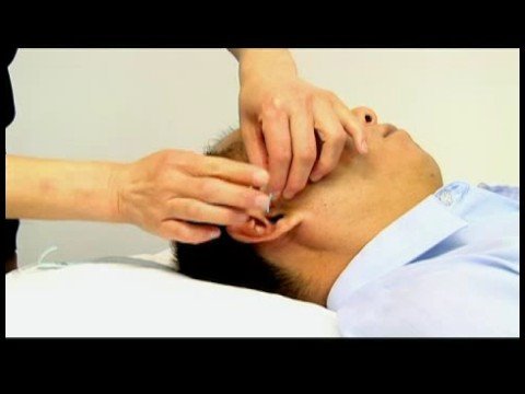Akupunktur Detoksifikasyon İçin: Akupunktur Sindirim Sistemi İçin