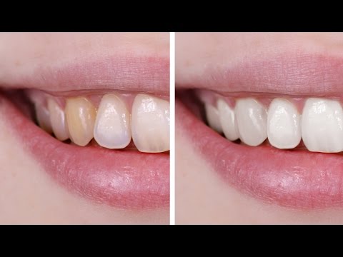 Nasıl Photoshop'ta Dişleri Beyazlatmak İçin