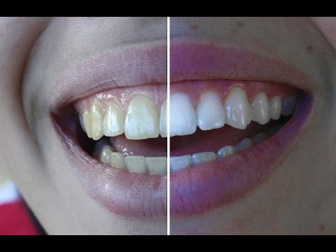 Nasıl Dişleri Beyazlatmak İçin | Photoshop Eğitimi